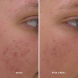 Clarify Clear Rescue Serum