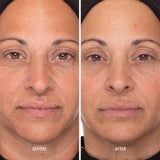 Retinol Routine Booster